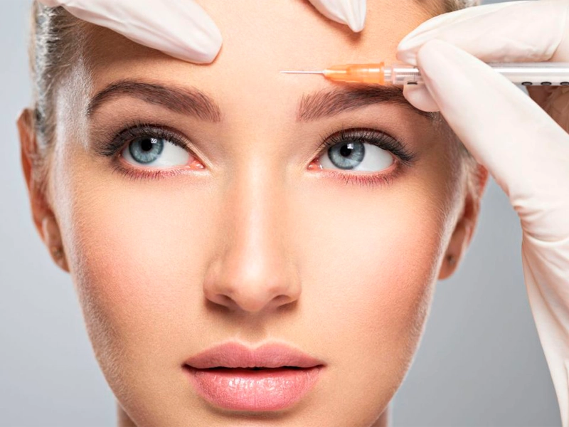 Infiltración Botox