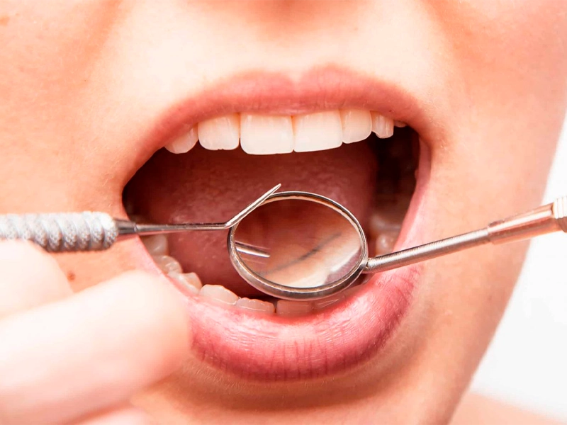Periodoncia
